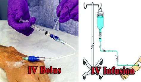 IV Bolus vs IV Infusion of Parenteral Drug Product