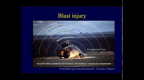 Orthopaedic blast injuries- Blast wave mechanics and primary blast injury (OTA lecture IV D01b ...