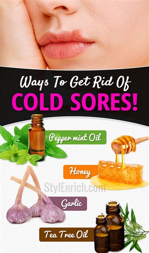 Cold Sore Remedies : 10 Natural Ways To Get Rid Of Cold Sores!