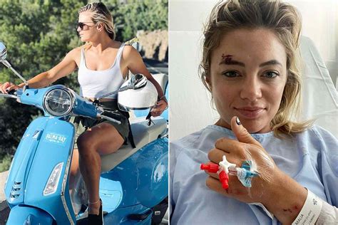 Below Deck Med's Malia White Hospitalized After Scooter Accident