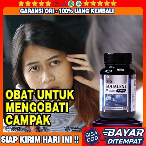 Jual Obat Campak Anak Dan Dewasa - Obat Campak Rubella - Obat Ruam - Obat Bintik Bintik Merah ...