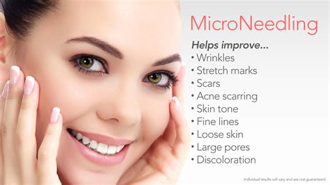 Microneedling and Microneedling with PRP • REN Dermatology