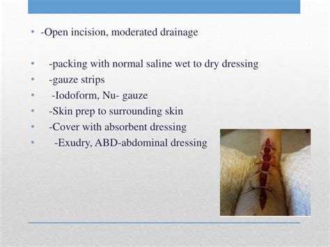 PPT - Wound care and Dressings PowerPoint Presentation - ID:6598179