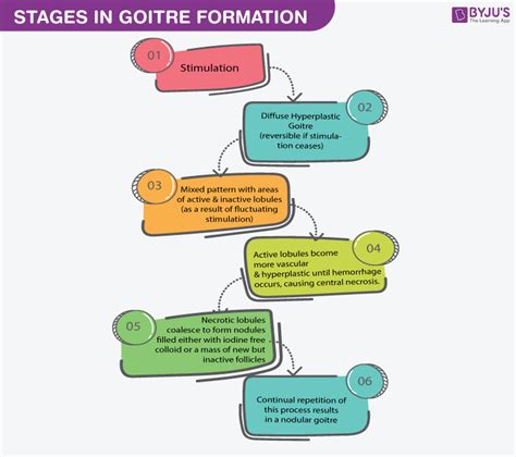 Multinodular Goitre: Meaning, Causes, Types, Symptoms, Treatment