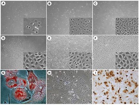 Human Hepatic Progenitor Cells Express Hematopoietic Cell Markers CD45 ...