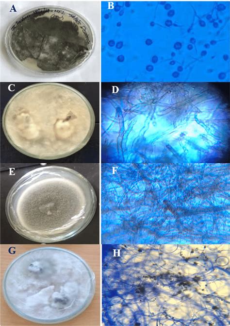 Endophytic Saprophytic fungi isolated in season I. A Photographic image ...