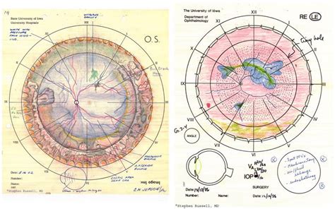 Retinal Drawing at GetDrawings | Free download