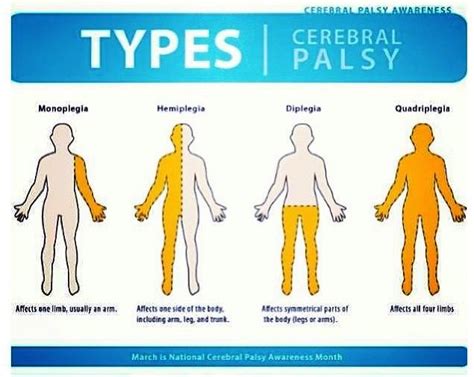 Cerebral Palsy: Classifications of Cerebral Palsy