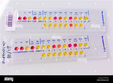 Bacterial test of urogenital mycoplasma Stock Photo - Alamy