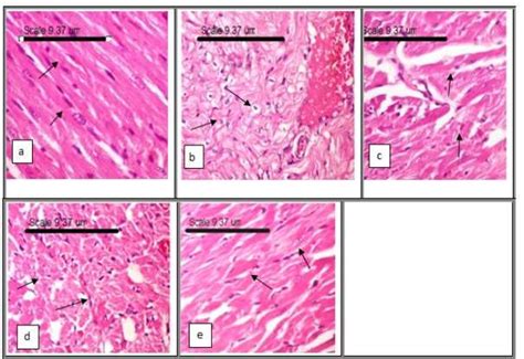 Cardiac Muscle Histology Labeled