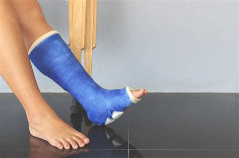 An Easier Recovery From Ankle Fractures | AICA Orthopedics