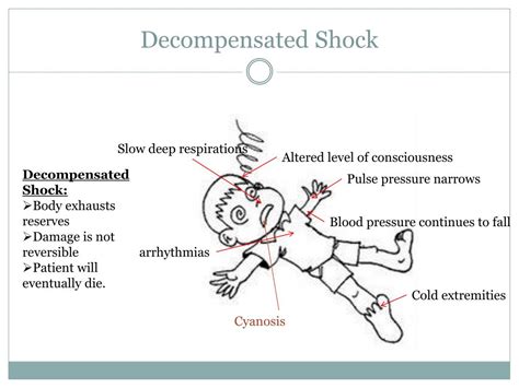 PPT - Shock and Bleeding in the Trauma Patient PowerPoint Presentation ...