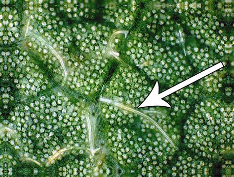 Cell Types, Trichomes