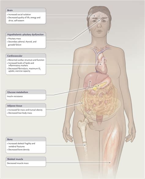 Pathogenesis and Diagnosis of Growth Hormone Deficiency in Adults | NEJM