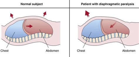 Control of Ventilation and Respiratory Muscles | Thoracic Key