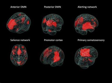 General 2 — Epilepsy Canada Epilepsi