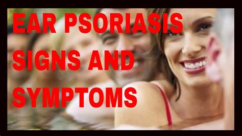 Ear Psoriasis Signs and Symptoms - YouTube