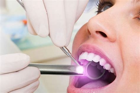 Oral Cancer Screening - Dr. Salim Nasser | Dentists in Markham - Dental ...