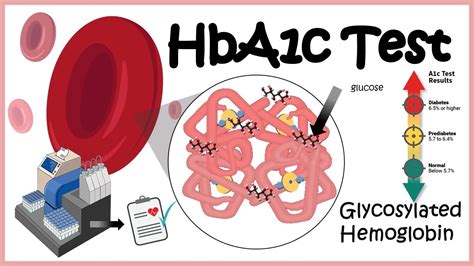 डायबिटीसचे अचूक निदान करण्यासाठी Hba1c टेस्ट करणे गरजेचे का आहे ...