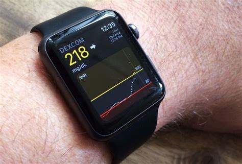 Apple Watch 3 Could Contain A Glucose Monitor For Diabetes Patients | Apple watch, Apple watch 3 ...