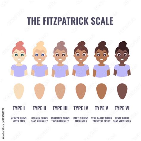 Fitzpatrick skin type classification scale shown in women. Human skin ...