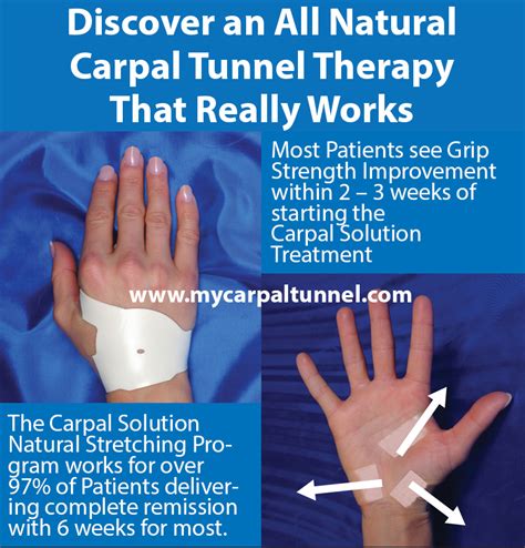 Carpal Tunnel Therapy | All Natural | Over 97% Success Rate