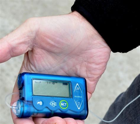 Medtronic Insulin Pumps Recalled After Dangerous Flaw Leaves One Dead ...