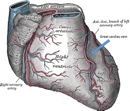 Great cardiac vein | Radiology Reference Article | Radiopaedia.org