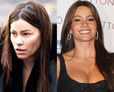 Sofia Vergara Plastic Surgery Opinion