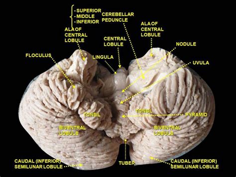 From Wikiwand: Cerebellum. Inferior surface. | Article writing, Tonsil ...