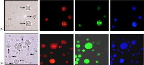 Bright field and fluorescence microscopy of 5 h-cocultures of Env + and ...