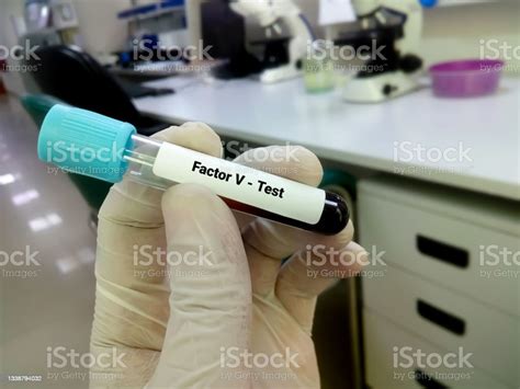 Blood Sample For Factor V Or Proaccelerin Or Labile Factor Test ...