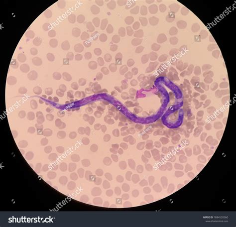 Microfilariae Not Sheathed Blood Smear Dog Stock Photo (Edit Now ...