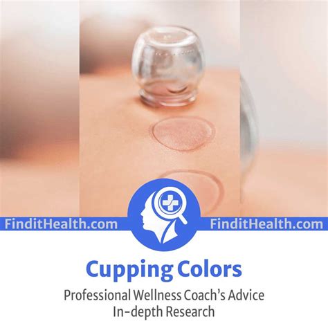 Cupping Colors (Marks Chart) : r/ManagingStress