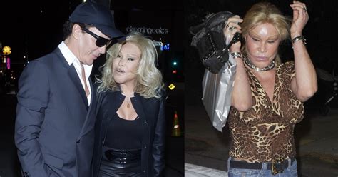 The Wildenstein-Klein Saga: Truth Behind Her Plastic Surgery