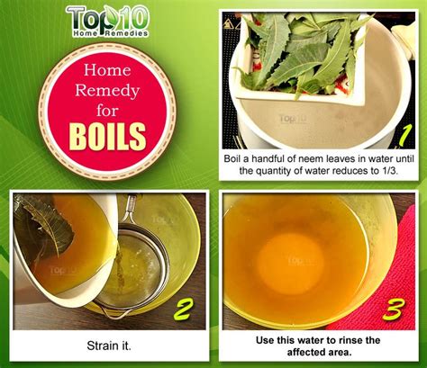 Home Remedies for Boils and Abscesses | Top 10 Home Remedies