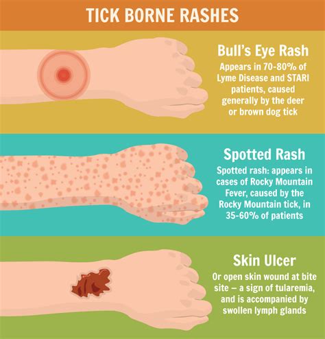 Precautions to Avoid Tick Bites | Fix.com