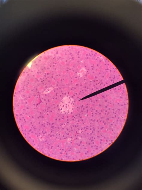 Pancreas Cell- Bio Lab Diagram | Quizlet