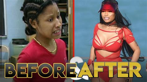 NICKI MINAJ | Before & After Transformation ( Plastic Surgery, Makeup & More ) - YouTube