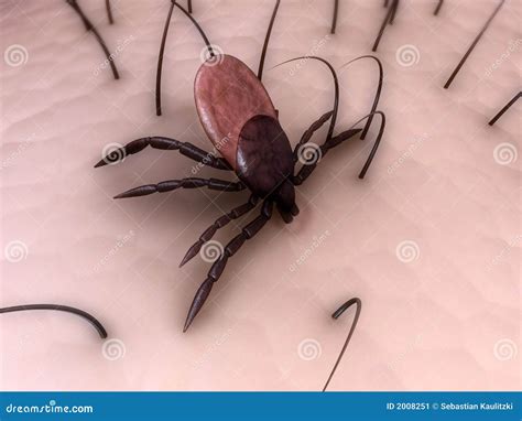 Tick bite stock illustration. Image of lyme, bloodsucker - 2008251