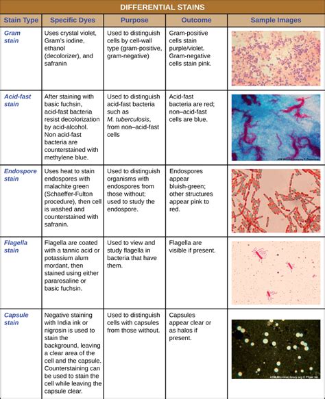 Acid Fast Staining Lab Report - MaraminTrujillo