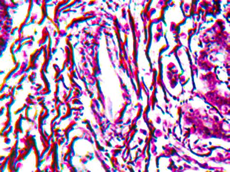 Reticulum Stain Kit – Diagnostic BioSystems (DBS)