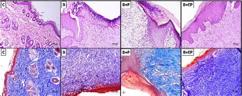 Figure 1 from Educated Platelets Promote Wound Healing via Anti-inflammatory Effect and Down ...