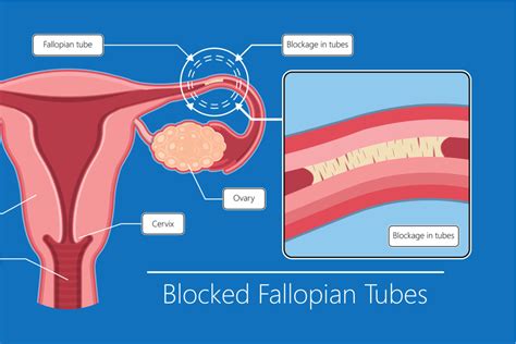 Fallopian Tube Diagram Egg