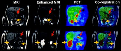 Scientific and Clinical Applications of Magnetic Carriers > Archive ...