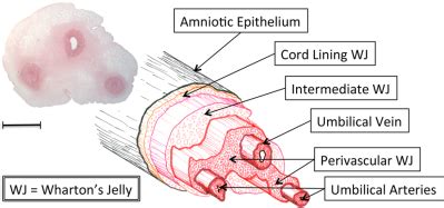 What’s the Stem Cells Buzz this Week? – ASC-Promoted Tumorigenesis ...