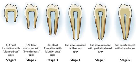 Regenerative Endodontic Procedures - Dental Clinics