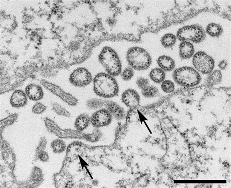 Orthomyxoviridae | Veterian Key