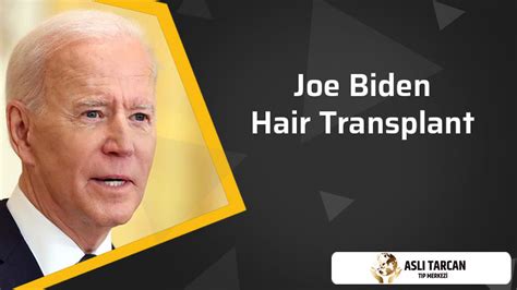 Joe Biden Hair Transplant | Asli Tarcan Clinic