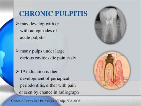 Pulpal & periradicular diseases & their diagnosis